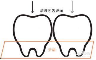 正确刷牙方法视频教程,告别口腔问题